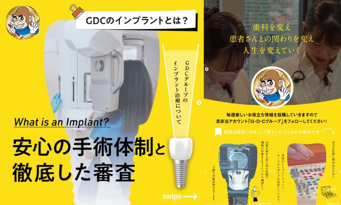 🔍 安心の理由が、ここにある。インプラントは“事前の診断”が命✨/Instagram更新しました！🌟