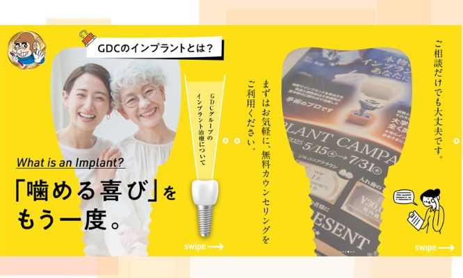 もう一度、“噛める幸せ”を。インプラント治療の魅力とは?✨/Instagram更新しました!