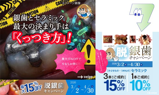 銀歯とセラミック、最大の決まり手は「くっつき方」！💡
