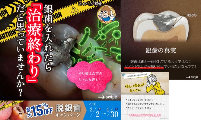 銀歯を入れたら「治療終わり」だと思っていませんか？🦷/Instagram更新しました🌈